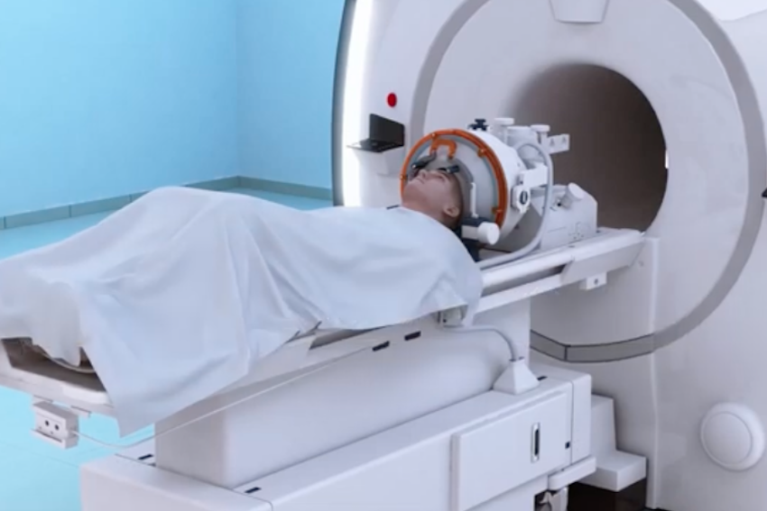 Focus ultrasound patient in the MRI machine